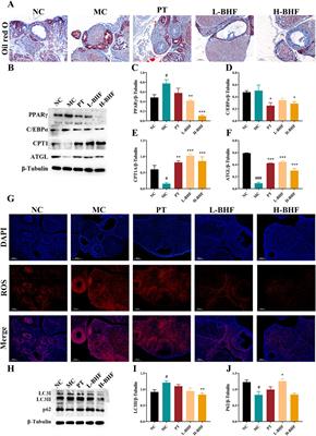 Bushen Huoxue formula attenuates lipid accumulation evoking excessive autophagy in premature ovarian insufficiency rats and palmitic acid-challenged KGN cells by modulating lipid metabolism